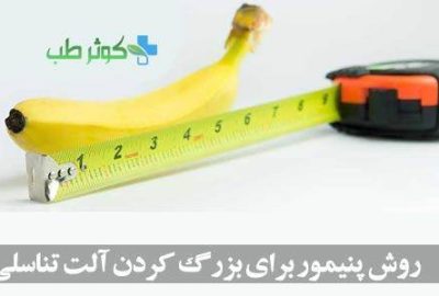 روش پنیمور چیست