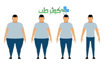 چاقی و لاغری چیست؟