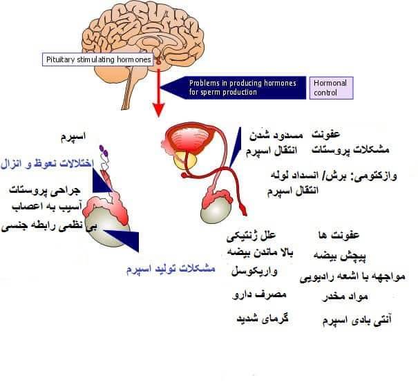 چگونه بفهمیم مرد نابارور است